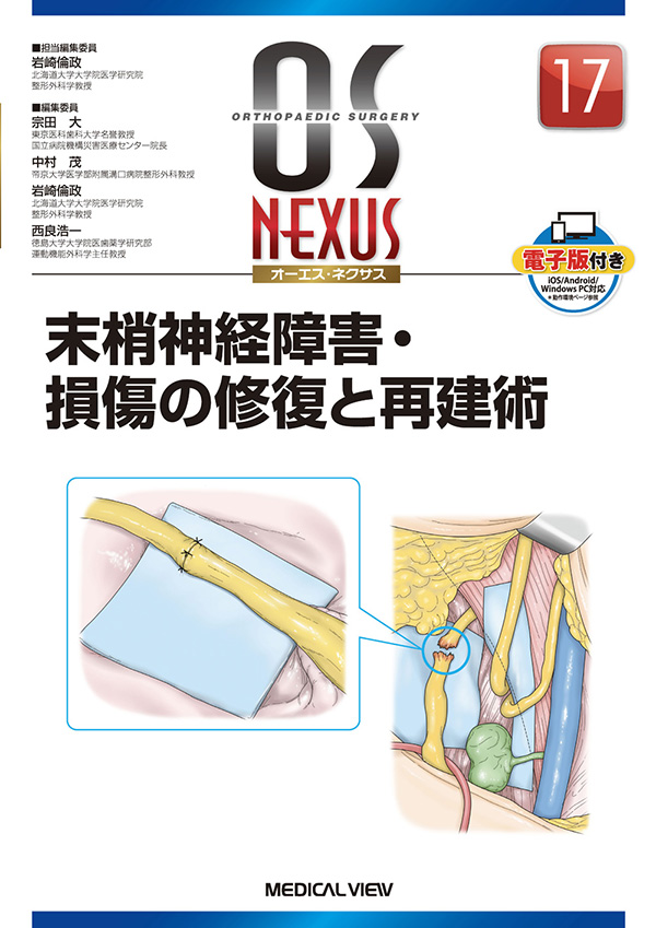手根管症候群に対する鏡視下手術　末梢神経障害・損傷の修復と再建術（OS NEXUS 17　メジカルビュー社 2018）