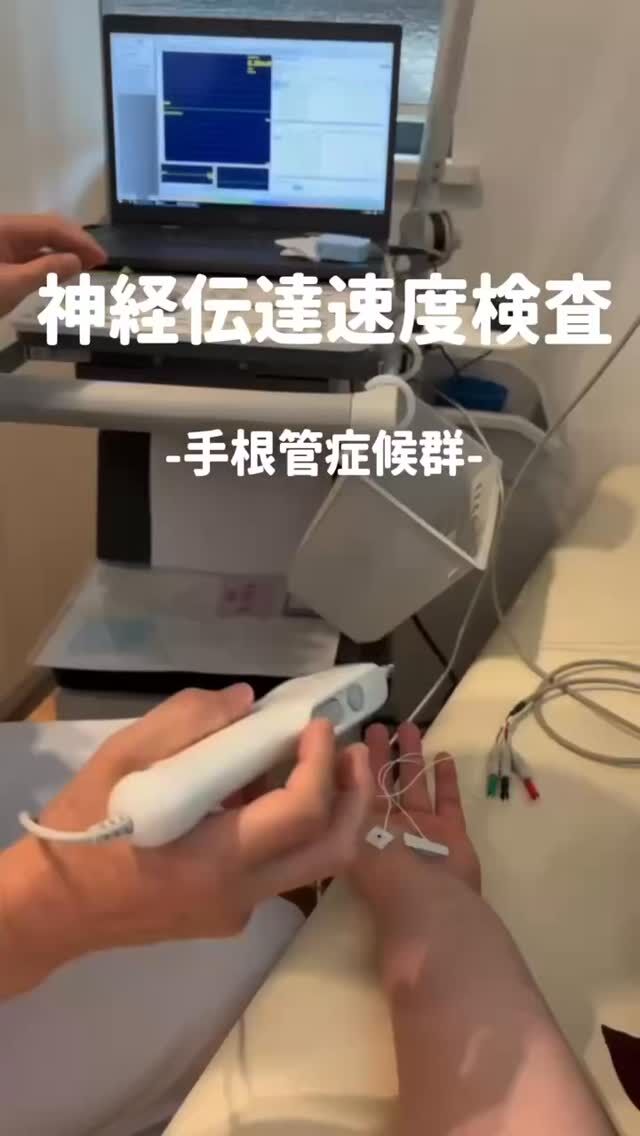🖐️「手のしびれ、なんだろう…？」
そんな症状がある方へ。

当院では、神経伝達速度検査を行っています🔍

神経にごく微弱な電気刺激を与え、
その刺激が神経をどのくらいの速さで伝わるのかを測定する検査です。

特に、
☑️ 親指・人差し指・中指にしびれがある
☑️ 手のひらがジンジンする
☑️ 夜間や明け方にしびれ・痛みが強くなる
☑️ 手に力が入りにくい
☑️ 細かい作業がしづらくなってきた

このような症状がある場合、手根管症候群などの可能性があります。

「これくらいなら大丈夫かな？」と我慢せず、
気になる症状があればお気軽にご相談ください🏥

当院では、症状や検査結果をもとに、
患者さま一人ひとりに合わせた治療をご提案します。
#福岡県 #久留米市 #整形外科 #神経伝達速度検査 #手根管症候群